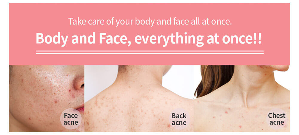 acne body wash