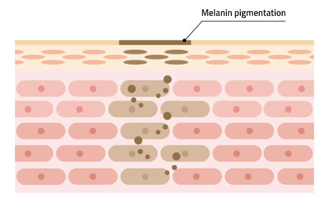 Blemish Serum