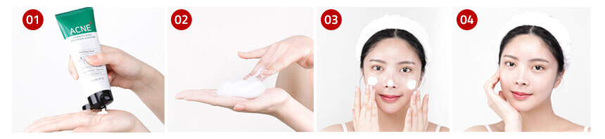 211130 30 days miracle acne cleansing foam 9 Korea Beauty For You