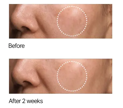 Dark spot serum, ANUA Niacinamide Niacinamide + TXA Serum