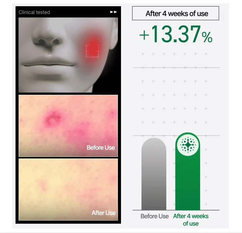 Spot care cream, ANUA Heartleaf Centella Red Spot Cream 30g