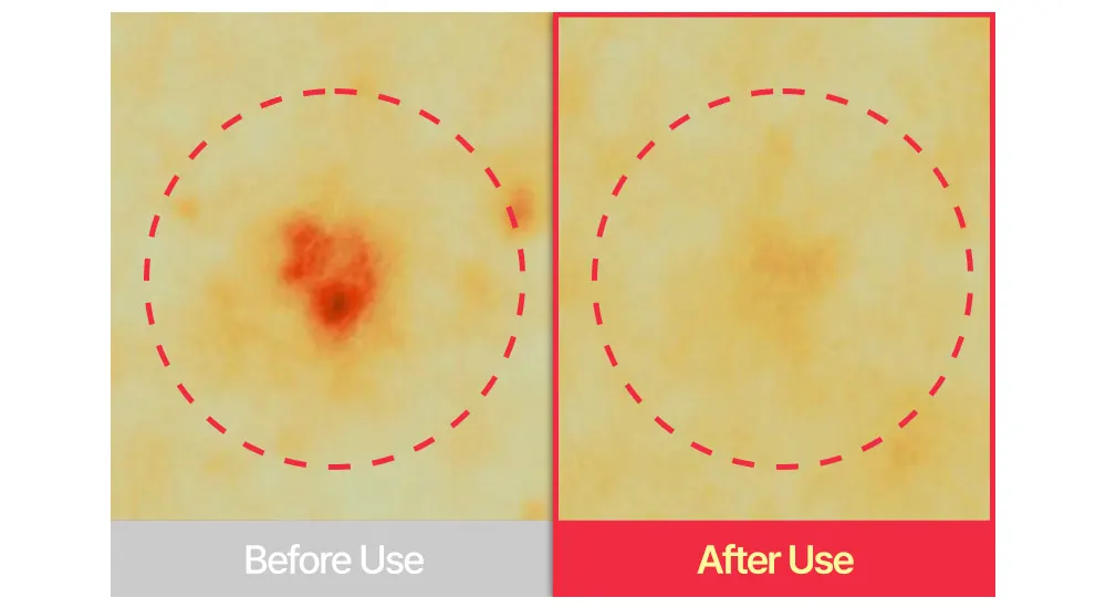 Acne Treatment Cream, SUNGBOON EDITOR Red Heartleaf BHA-Lino Trouble Relief Soothing Cream 50ml