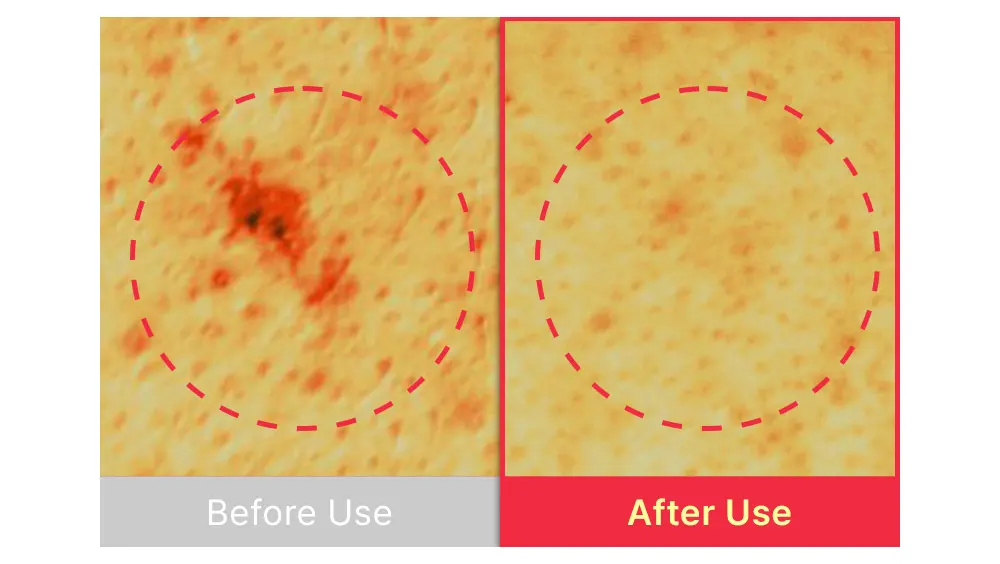 The best acne serum, SBEDT Red Heartleaf BHA-Lino Relief Ampoule