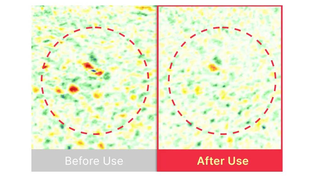 The best acne serum, SBEDT Red Heartleaf BHA-Lino Relief Ampoule