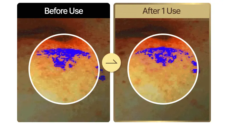 EASYDEW EGF Retinol Cream 0.3% 15ml/0.03% 30ml