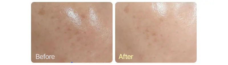 EASYDEW EGF Retinol Cream 0.3% 15ml/0.03% 30ml