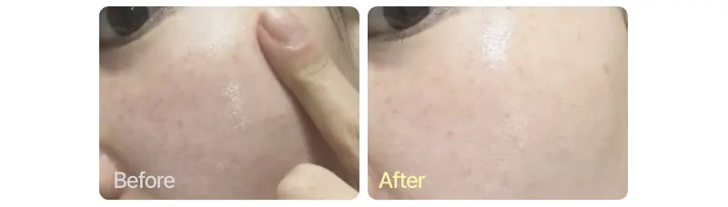 EASYDEW EGF Retinol Cream 0.3% 15ml/0.03% 30ml