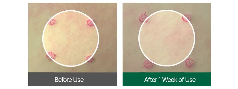 Face Tightening Serum, EASYDEW Lift Core Effect Ampoule 15ml