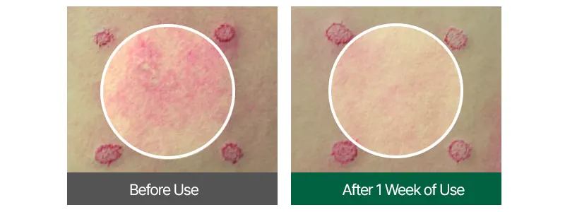 Face Tightening Serum, EASYDEW Lift Core Effect Ampoule 15ml