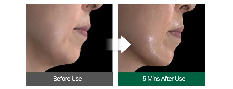 Face Tightening Serum, EASYDEW Lift Core Effect Ampoule 15ml