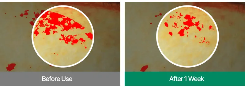 EASYDEW DW-EGF 10ppm Oneday MTS 2700 Korea Beauty For You Microneedling at home, EASYDEW DW-EGF 10ppm Oneday MTS 2700