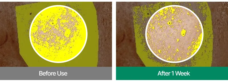 EASYDEW DW-EGF 10ppm Oneday MTS 2700 Korea Beauty For You Microneedling at home, EASYDEW DW-EGF 10ppm Oneday MTS 2700