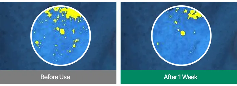 EASYDEW DW-EGF 10ppm Oneday MTS 2700 Korea Beauty For You Microneedling at home, EASYDEW DW-EGF 10ppm Oneday MTS 2700