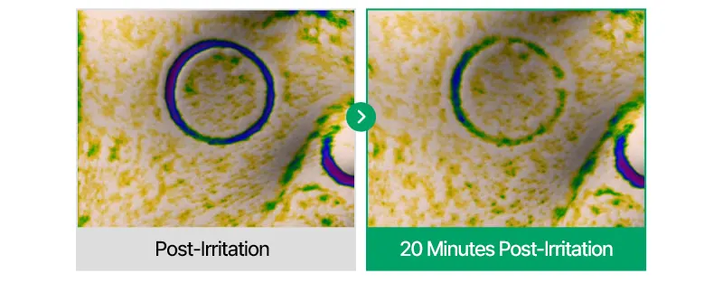 EASYDEW Post-Laser DW EGF Cream 40ml Korea Beauty For You Recovery Cream, EASYDEW Post Laser DW EGF Cream 40ml