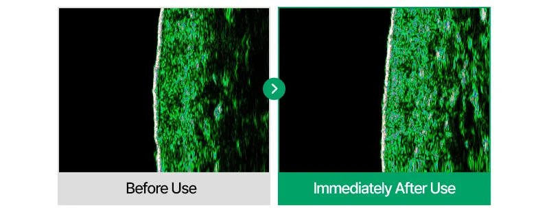 EASYDEW Post-Laser DW EGF Cream 40ml Korea Beauty For You Recovery Cream, EASYDEW Post Laser DW EGF Cream 40ml