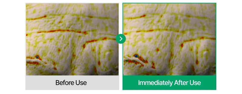 EASYDEW Post-Laser DW EGF Cream 40ml Korea Beauty For You Recovery Cream, EASYDEW Post Laser DW EGF Cream 40ml