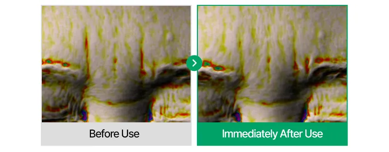 EASYDEW Post-Laser DW EGF Cream 40ml Korea Beauty For You Recovery Cream, EASYDEW Post Laser DW EGF Cream 40ml