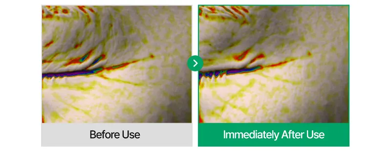 EASYDEW Post-Laser DW EGF Cream 40ml Korea Beauty For You Recovery Cream, EASYDEW Post Laser DW EGF Cream 40ml