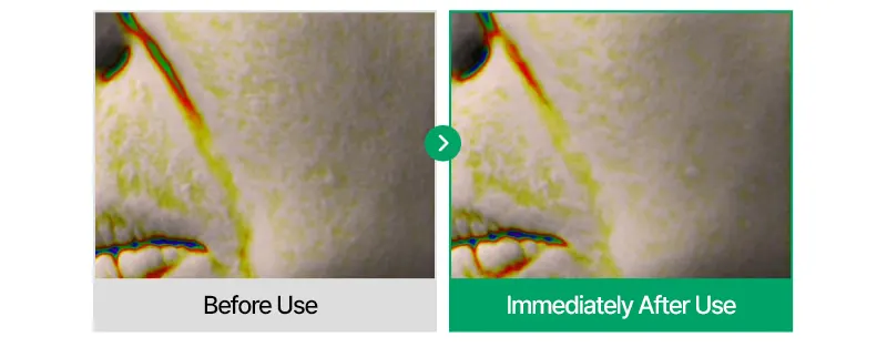 EASYDEW Post-Laser DW EGF Cream 40ml Korea Beauty For You Recovery Cream, EASYDEW Post Laser DW EGF Cream 40ml