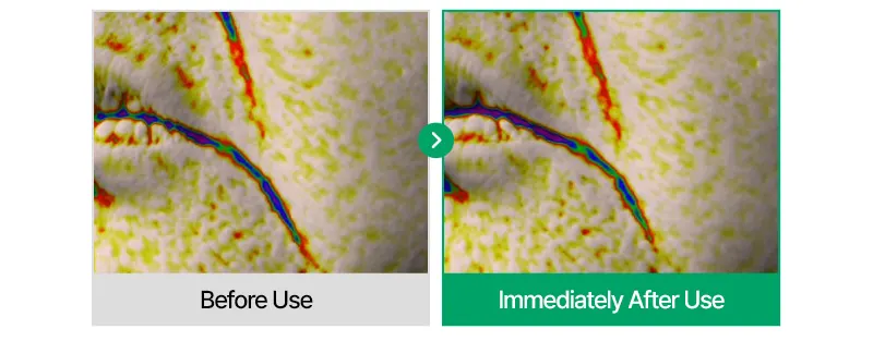 EASYDEW Post-Laser DW EGF Cream 40ml Korea Beauty For You Recovery Cream, EASYDEW Post Laser DW EGF Cream 40ml