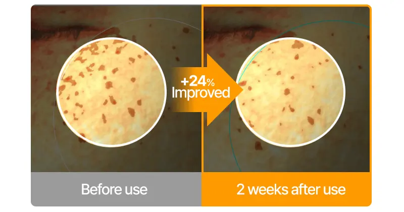 EASYDEW Vitamin C Boosting Ampoule 25 15g