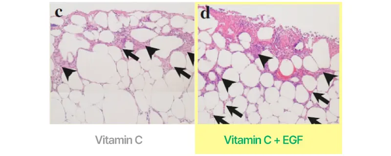 Vitamin C Boosting Ampoule07 Korea Beauty For You