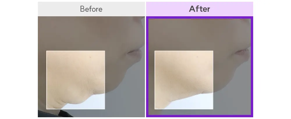 EOA HIFU Fulthera Pro, At-home HIFU Machine Korea Beauty For You EOA HIFU Fulthera Pro, At-home HIFU Machine
