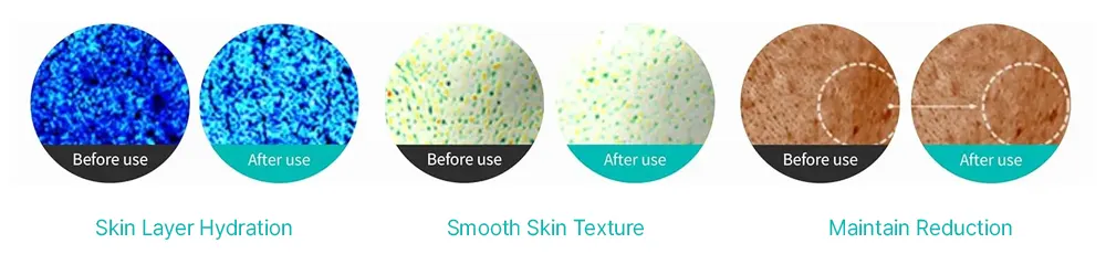 REJURAN Turnover Cream Enhanced 50ml
