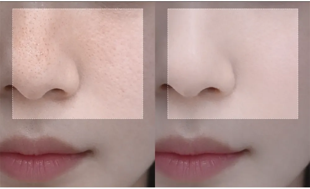 EOA Fultenza, Pore Tightening Device Korea Beauty For You EOA Fultenza, Pore Tightening Device