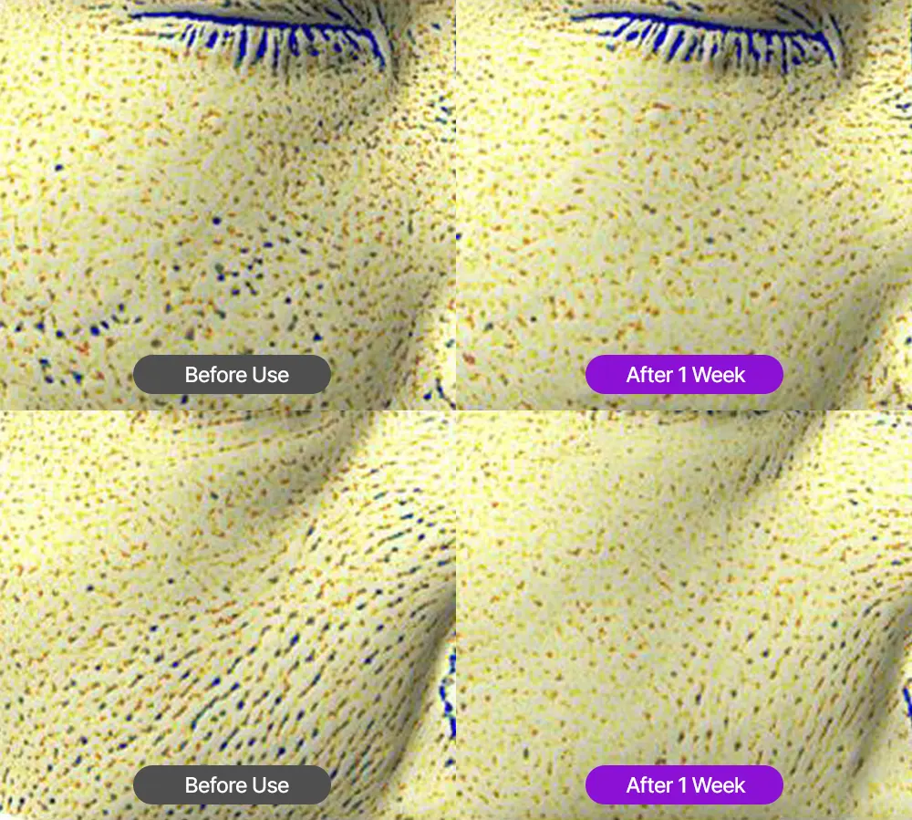 FATION NOSCA9 Pore Enhancing Serum 30ml / 1.01 fl. oz. Korea Beauty For You Before and after results showing how the pore refining serum minimizes the appearance of pores