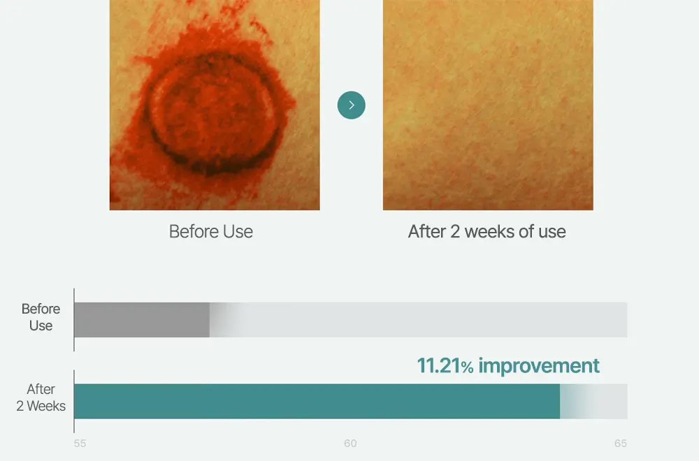 REJURAN Turnover Ampoule 30ml / 50ml Korea Beauty For You Infographic showing an 11.21% improvement in the skin turnover cycle after 2 weeks of using the Rejuran glass skin serum